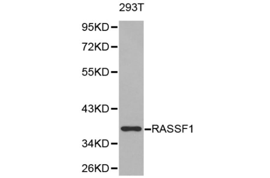 Anti-RASSF1 Antibody from Bioworld Technology (BS6244) - Antibodies.com