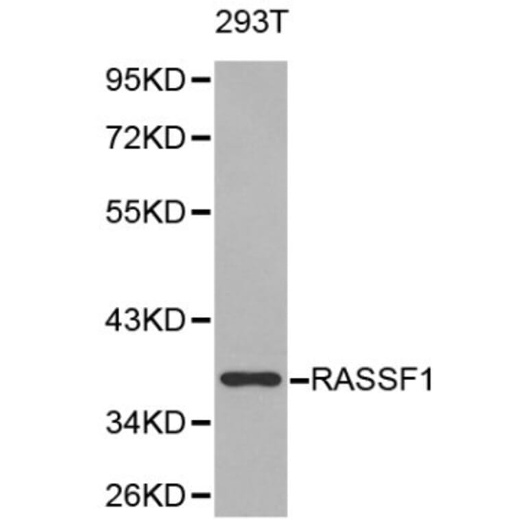 Anti-RASSF1 Antibody from Bioworld Technology (BS6244) - Antibodies.com