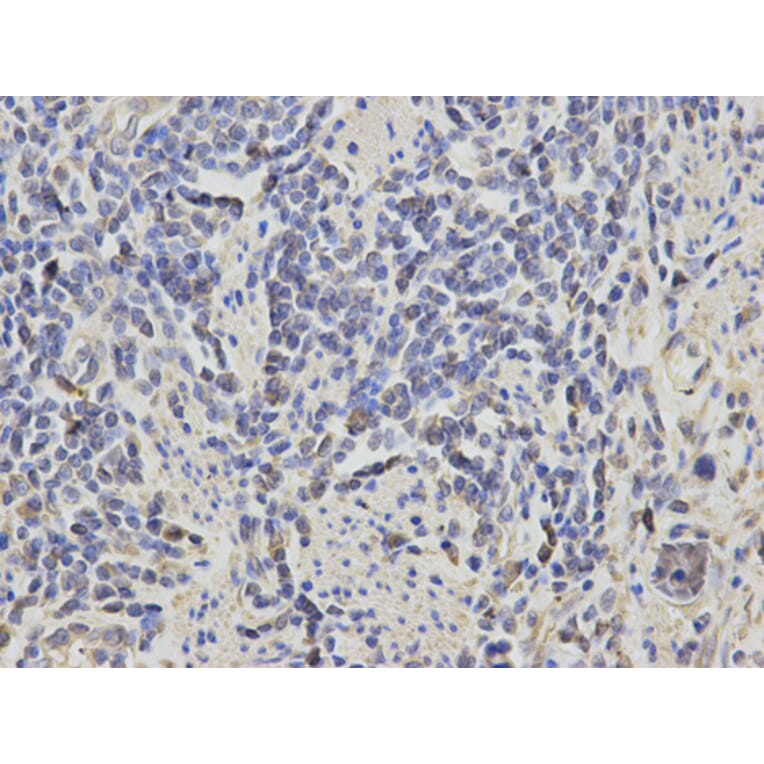 Anti-RASSF1 Antibody from Bioworld Technology (BS6244) - Antibodies.com