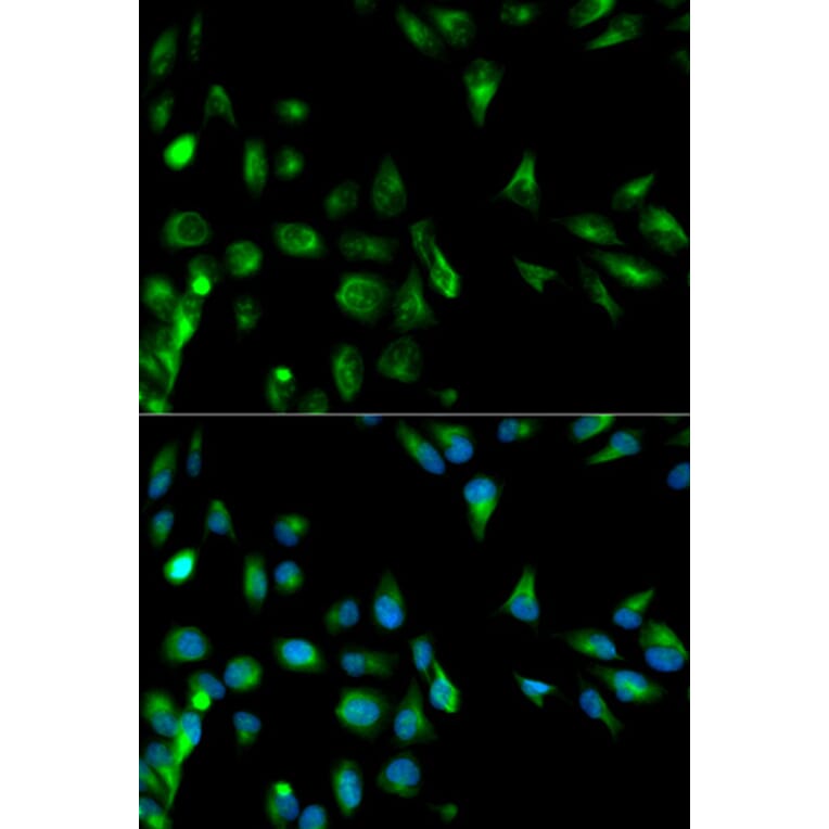 Anti-RASSF1 Antibody from Bioworld Technology (BS6244) - Antibodies.com