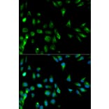 Anti-RASSF1 Antibody from Bioworld Technology (BS6244) - Antibodies.com