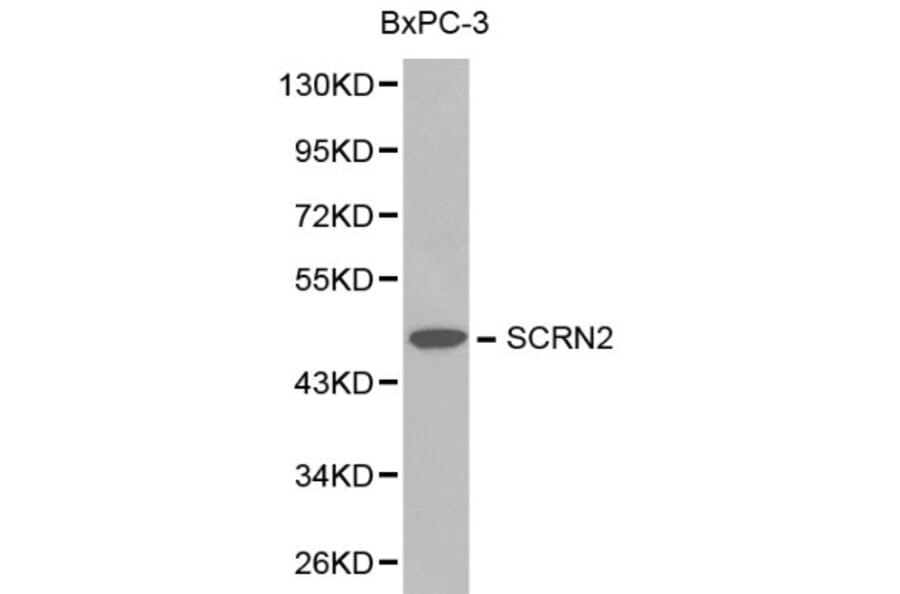 Anti-SCRN2 Antibody from Bioworld Technology (BS6246) - Antibodies.com