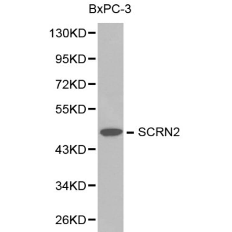 Anti-SCRN2 Antibody from Bioworld Technology (BS6246) - Antibodies.com