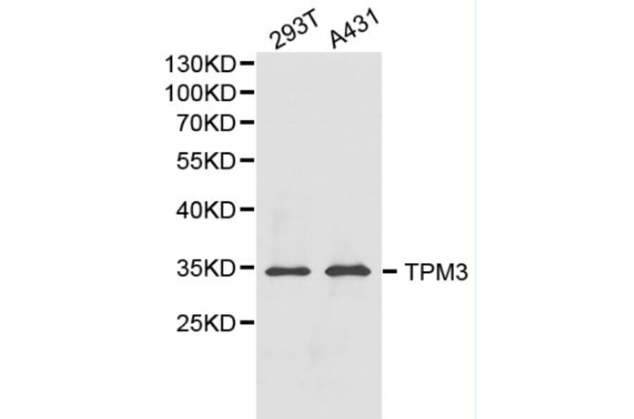 Anti-TPM3 Antibody from Bioworld Technology (BS6247) - Antibodies.com