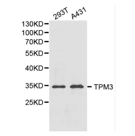 Anti-TPM3 Antibody from Bioworld Technology (BS6247) - Antibodies.com