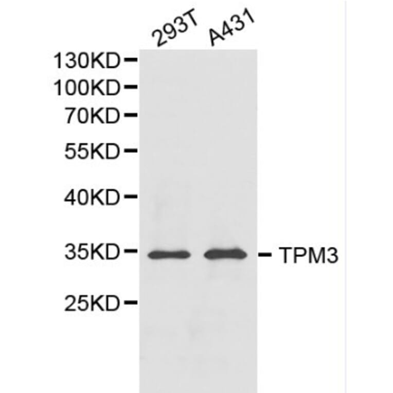 Anti-TPM3 Antibody from Bioworld Technology (BS6247) - Antibodies.com