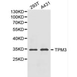 Anti-TPM3 Antibody from Bioworld Technology (BS6247) - Antibodies.com