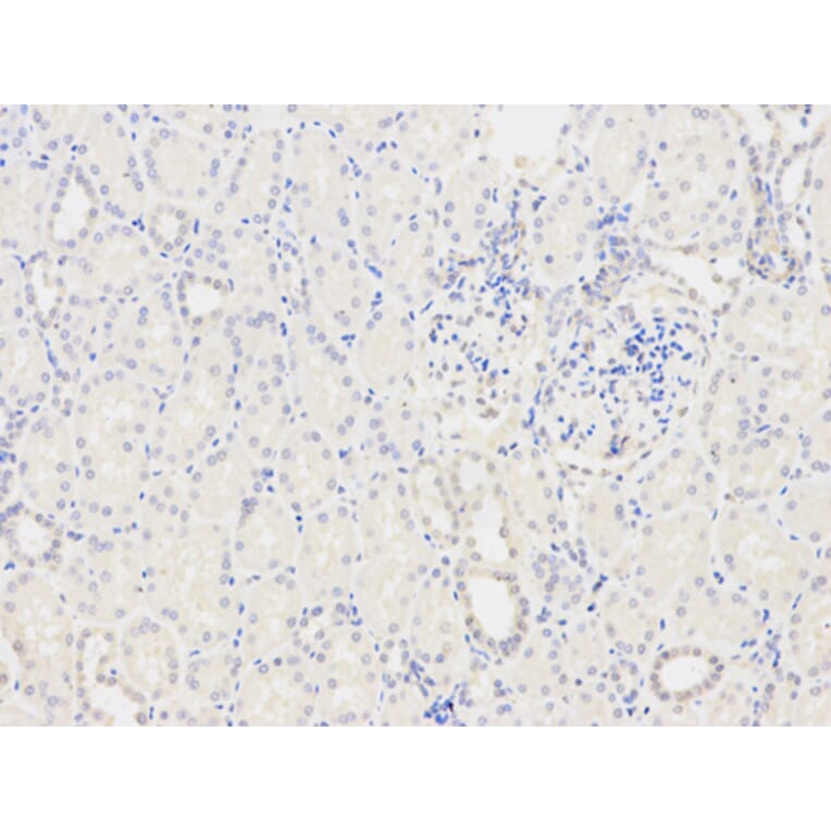 Anti-TPM3 Antibody from Bioworld Technology (BS6247) - Antibodies.com