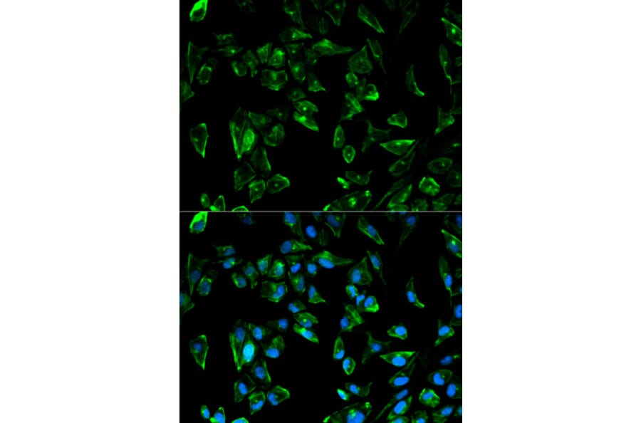 Anti-TPM3 Antibody from Bioworld Technology (BS6247) - Antibodies.com