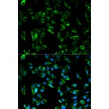 Anti-TPM3 Antibody from Bioworld Technology (BS6247) - Antibodies.com
