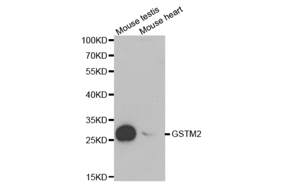 Anti-GSTM2 Antibody from Bioworld Technology (BS6248) - Antibodies.com