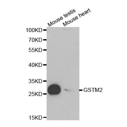 Anti-GSTM2 Antibody from Bioworld Technology (BS6248) - Antibodies.com