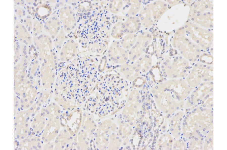 Anti-GSTM2 Antibody from Bioworld Technology (BS6248) - Antibodies.com