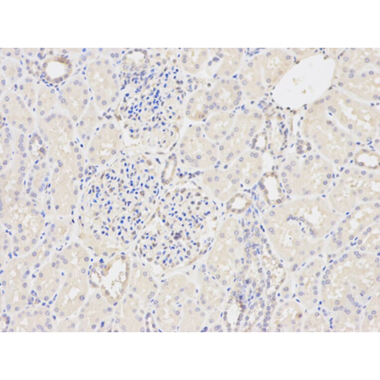 Anti-GSTM2 Antibody from Bioworld Technology (BS6248) - Antibodies.com