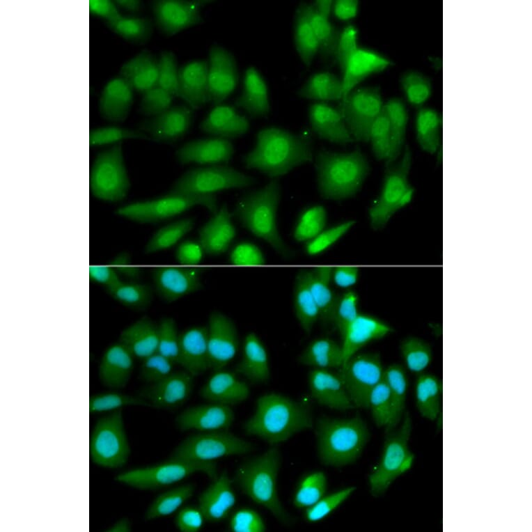 Anti-GSTM2 Antibody from Bioworld Technology (BS6248) - Antibodies.com