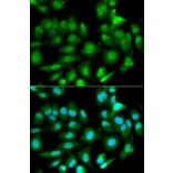 Anti-GSTM2 Antibody from Bioworld Technology (BS6248) - Antibodies.com