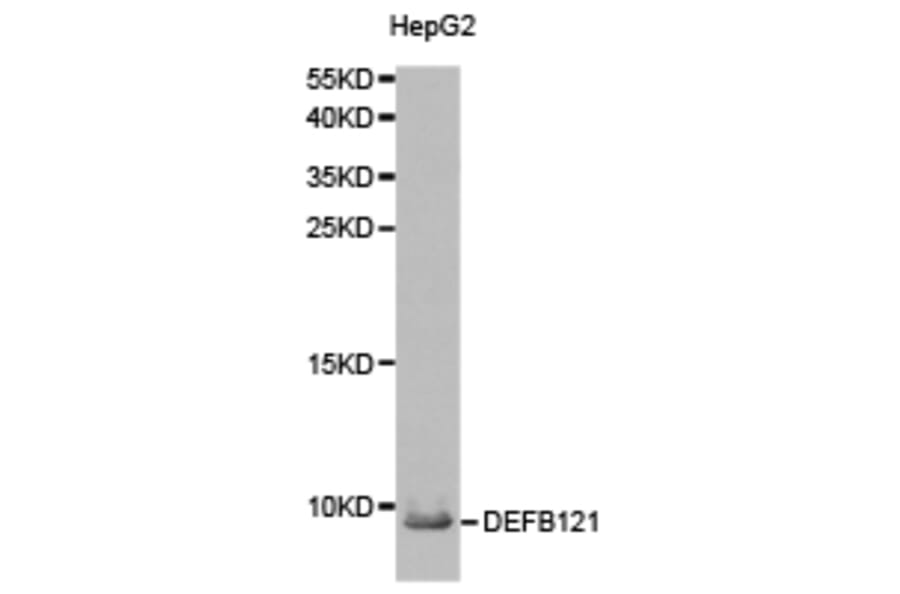 Anti-DEFB121 Antibody from Bioworld Technology (BS6249) - Antibodies.com