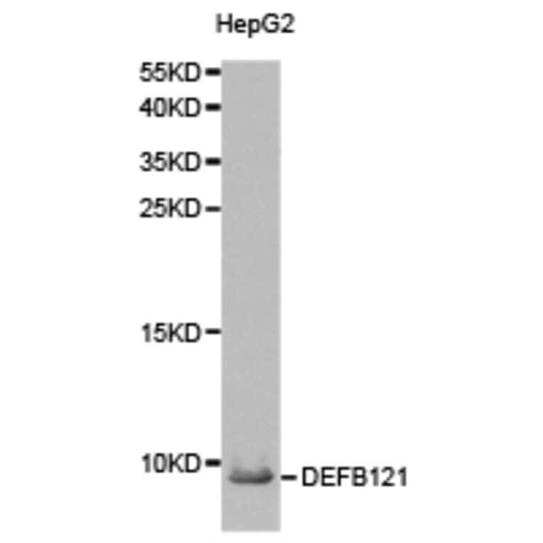 Anti-DEFB121 Antibody from Bioworld Technology (BS6249) - Antibodies.com