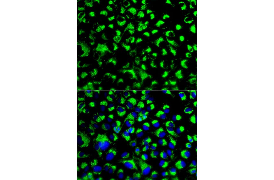 Anti-GRP75 Antibody from Bioworld Technology (BS6250) - Antibodies.com