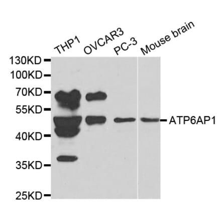 Anti-ATP6AP1 Antibody from Bioworld Technology (BS6251) - Antibodies.com