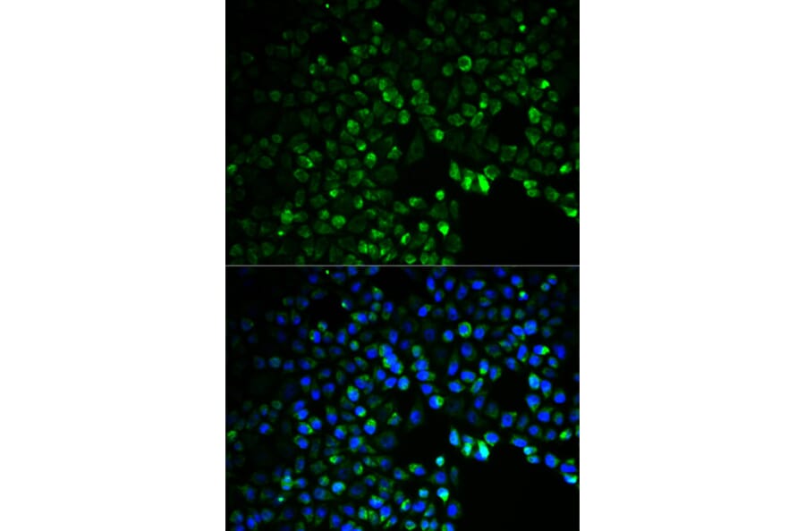 Anti-UGDH Antibody from Bioworld Technology (BS6252) - Antibodies.com