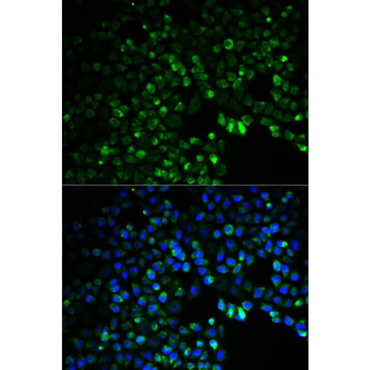 Anti-UGDH Antibody from Bioworld Technology (BS6252) - Antibodies.com