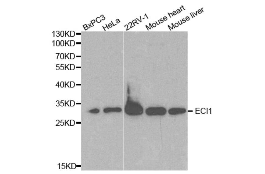 Anti-ECI1 Antibody from Bioworld Technology (BS6253) - Antibodies.com