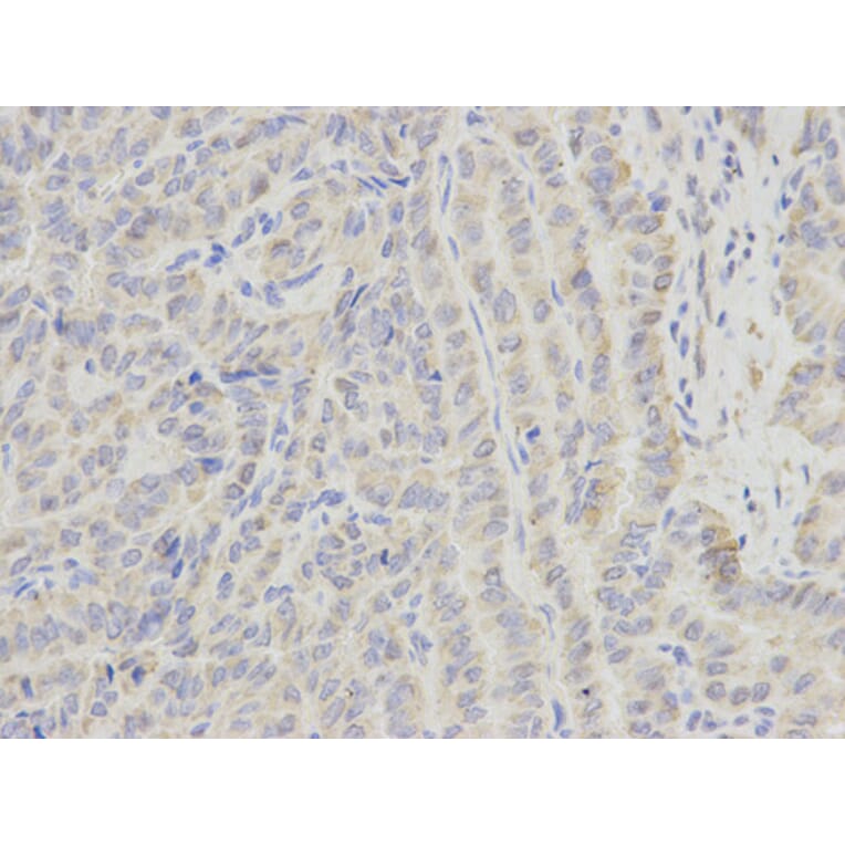 Anti-ECI1 Antibody from Bioworld Technology (BS6253) - Antibodies.com