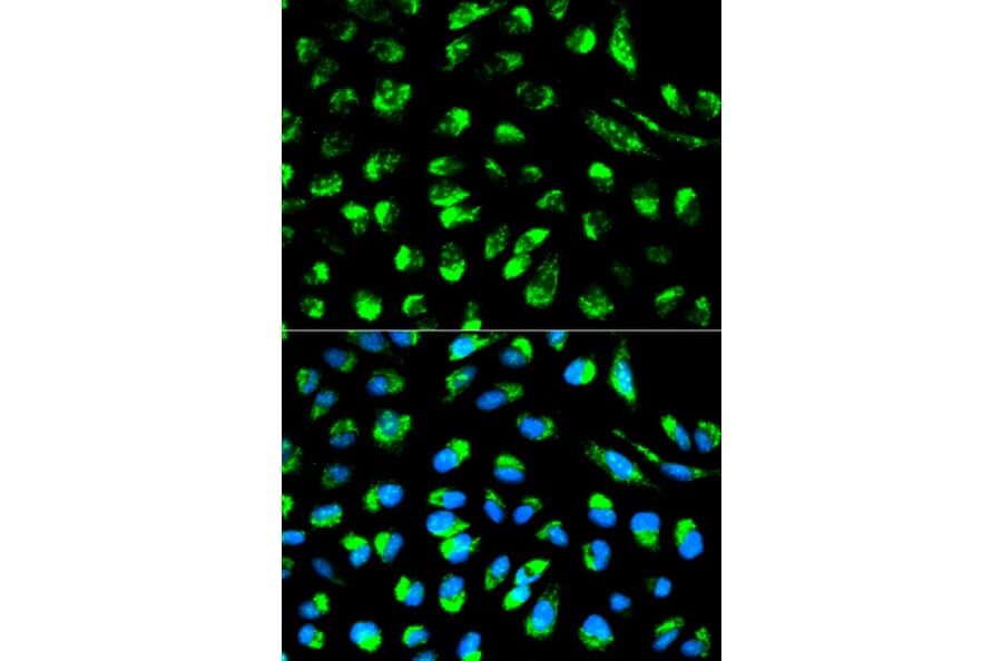 Anti-ECI1 Antibody from Bioworld Technology (BS6253) - Antibodies.com