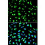 Anti-ECI1 Antibody from Bioworld Technology (BS6253) - Antibodies.com