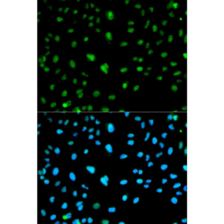 Anti-CA3 Antibody from Bioworld Technology (BS6254) - Antibodies.com