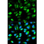 Anti-ARHGDIA Antibody from Bioworld Technology (BS6256) - Antibodies.com