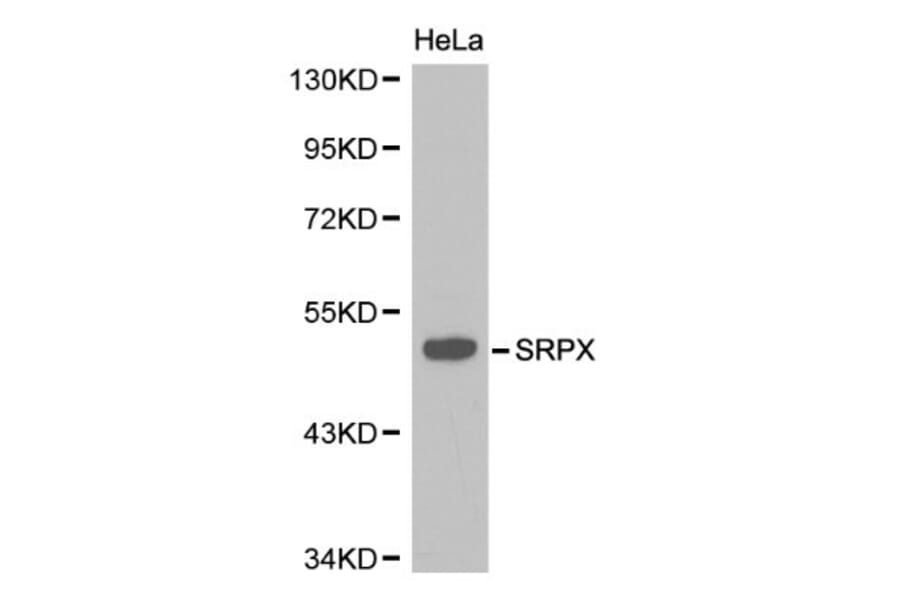 Anti-SRPX Antibody from Bioworld Technology (BS6259) - Antibodies.com