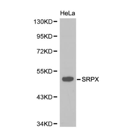 Anti-SRPX Antibody from Bioworld Technology (BS6259) - Antibodies.com