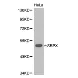 Anti-SRPX Antibody from Bioworld Technology (BS6259) - Antibodies.com