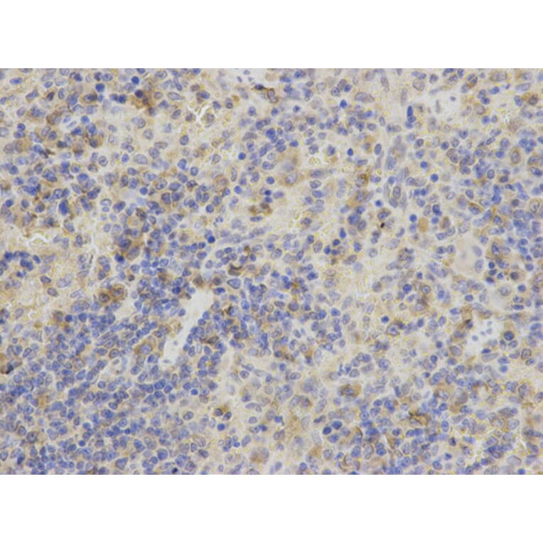 Anti-AK1 Antibody from Bioworld Technology (BS6260) - Antibodies.com