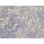 Anti-AK1 Antibody from Bioworld Technology (BS6260) - Antibodies.com