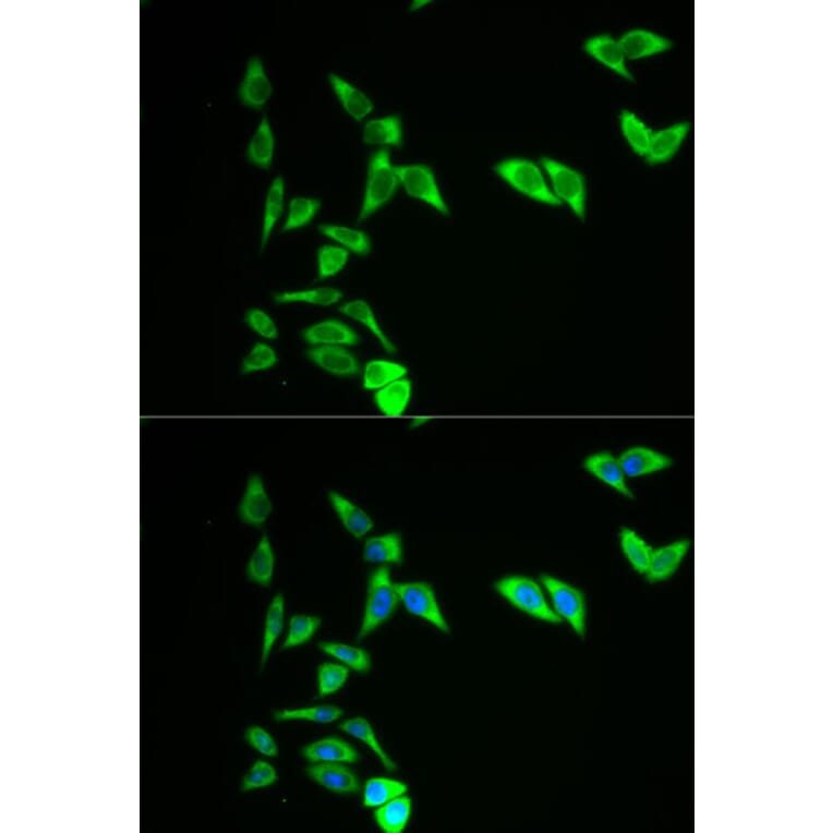 Anti-AK1 Antibody from Bioworld Technology (BS6260) - Antibodies.com