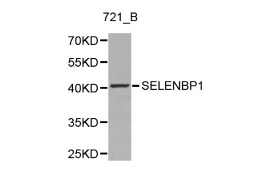 Anti-SELENBP1 Antibody from Bioworld Technology (BS6264) - Antibodies.com