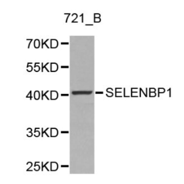 Anti-SELENBP1 Antibody from Bioworld Technology (BS6264) - Antibodies.com