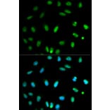 Anti-SELENBP1 Antibody from Bioworld Technology (BS6264) - Antibodies.com