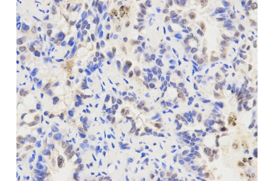 Anti-ALDH2 Antibody from Bioworld Technology (BS6268) - Antibodies.com