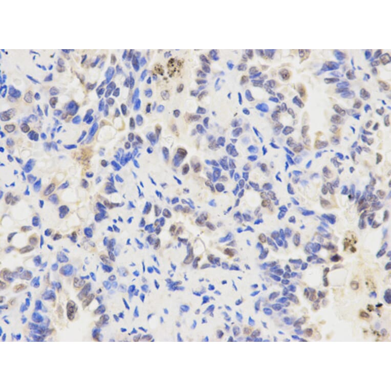 Anti-ALDH2 Antibody from Bioworld Technology (BS6268) - Antibodies.com