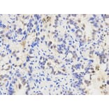 Anti-ALDH2 Antibody from Bioworld Technology (BS6268) - Antibodies.com