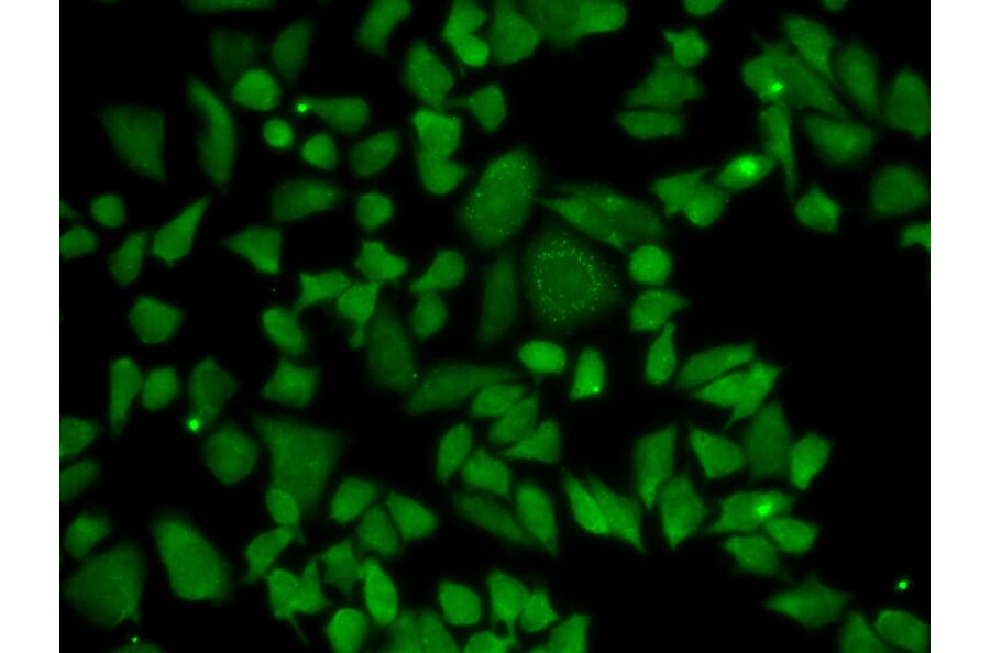 Anti-ALDH2 Antibody from Bioworld Technology (BS6268) - Antibodies.com