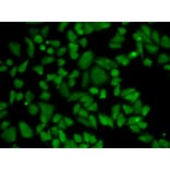 Anti-ALDH2 Antibody from Bioworld Technology (BS6268) - Antibodies.com