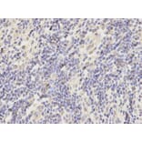 Anti-AKR7A2 Antibody from Bioworld Technology (BS6269) - Antibodies.com