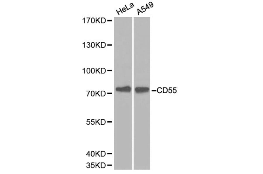 Anti-CD55 Antibody from Bioworld Technology (BS6270) - Antibodies.com