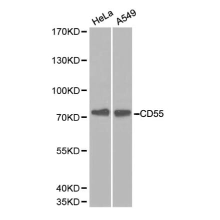 Anti-CD55 Antibody from Bioworld Technology (BS6270) - Antibodies.com