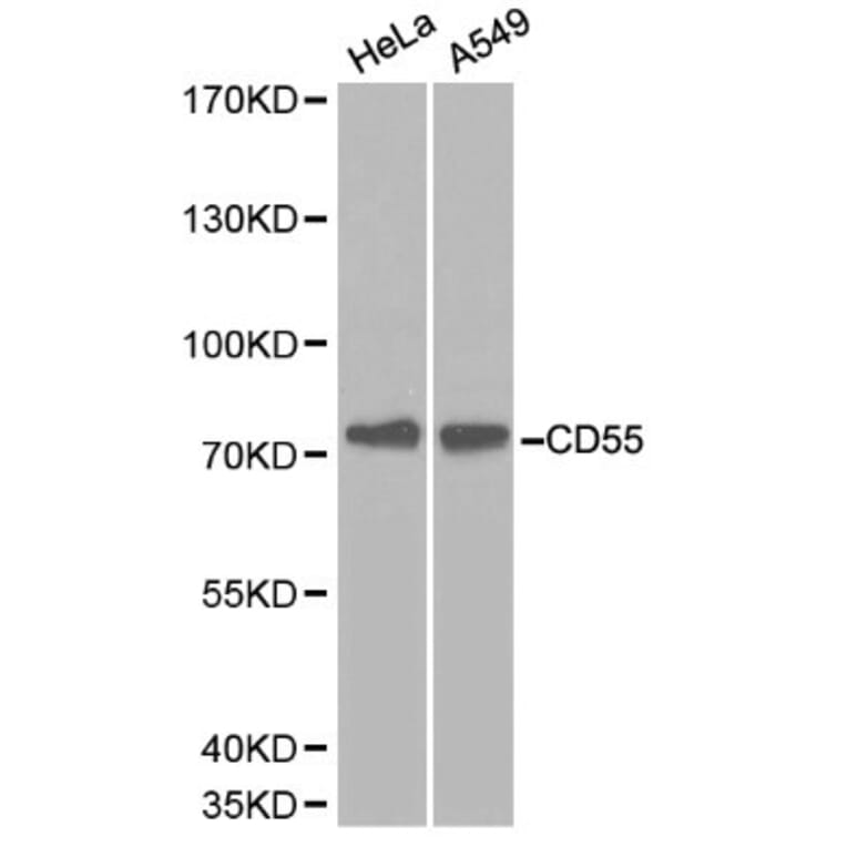 Anti-CD55 Antibody from Bioworld Technology (BS6270) - Antibodies.com